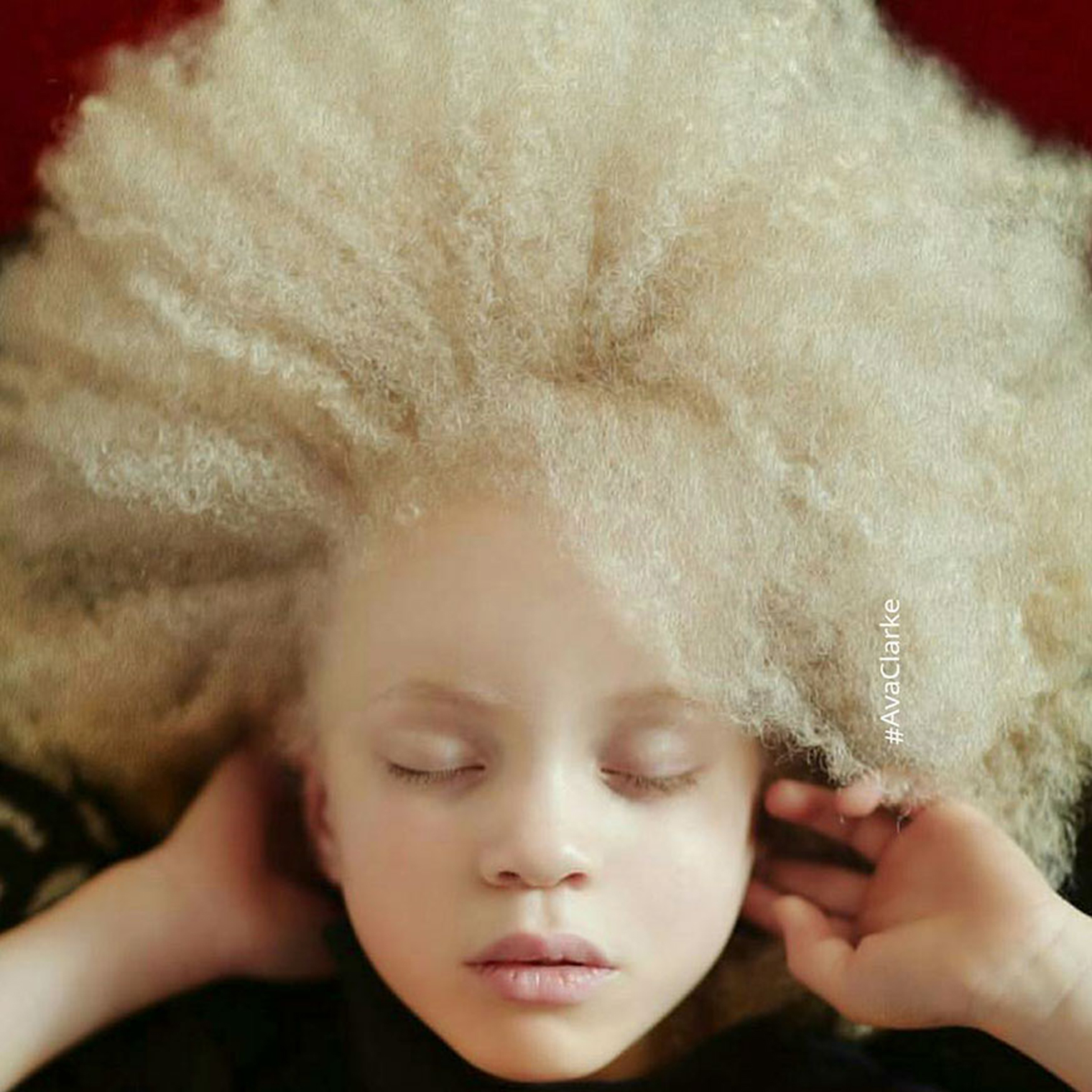 Альбинизмом страдают. Ава Кларк — афроамериканка-альбинос.. Альбинизм 1b. Ава Кларк (Ava Clarke). Катерина Тимошенко альбинос.