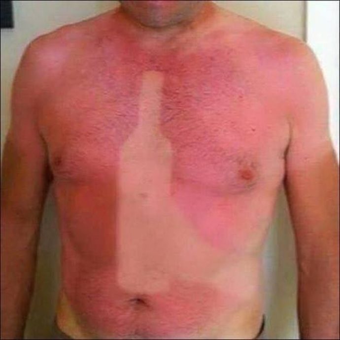 Sol da Zoeira? 15 Provas que o sol pode ser seu pior inimigo se você esquecer dele.