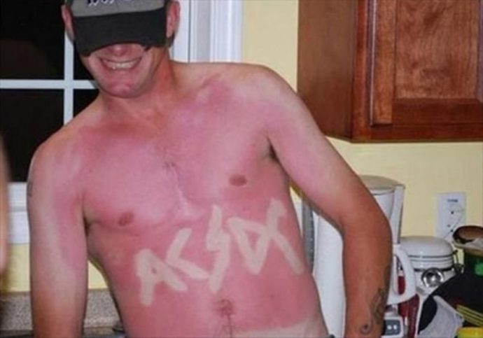 Sol da Zoeira? 15 Provas que o sol pode ser seu pior inimigo se você esquecer dele.