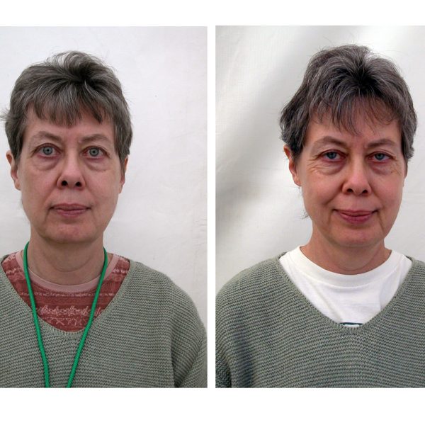07beforeafterF