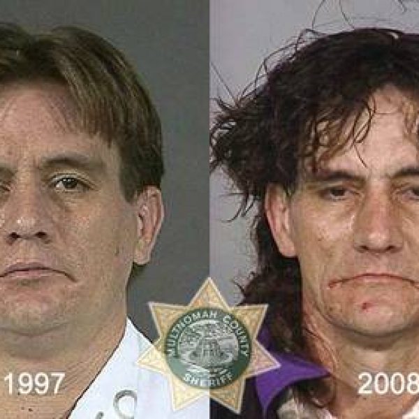 Antes e depois das drogas 6