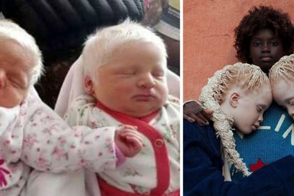 albino_babies_snow_white_hair_featured