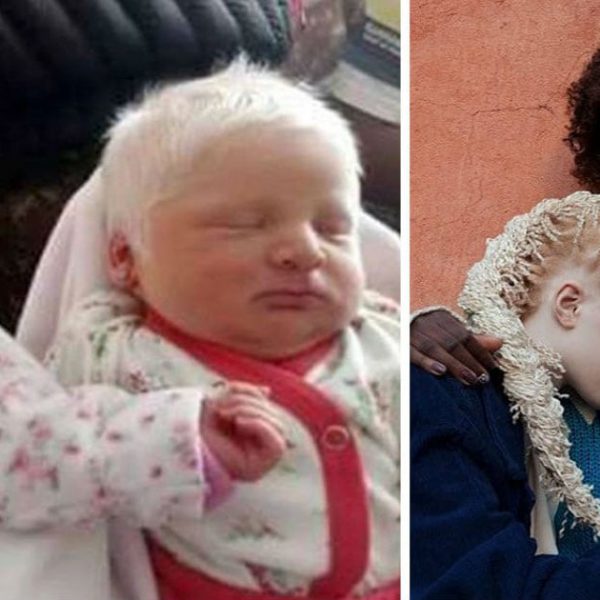 albino_babies_snow_white_hair_featured