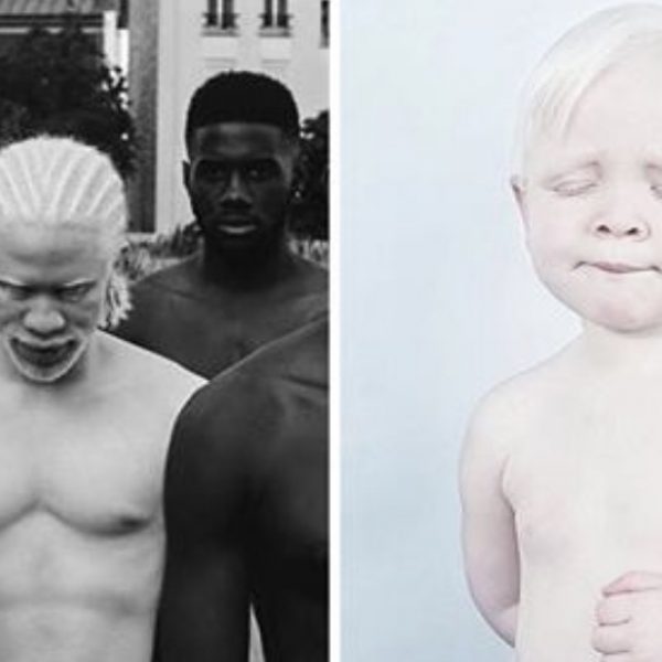 albinos capa