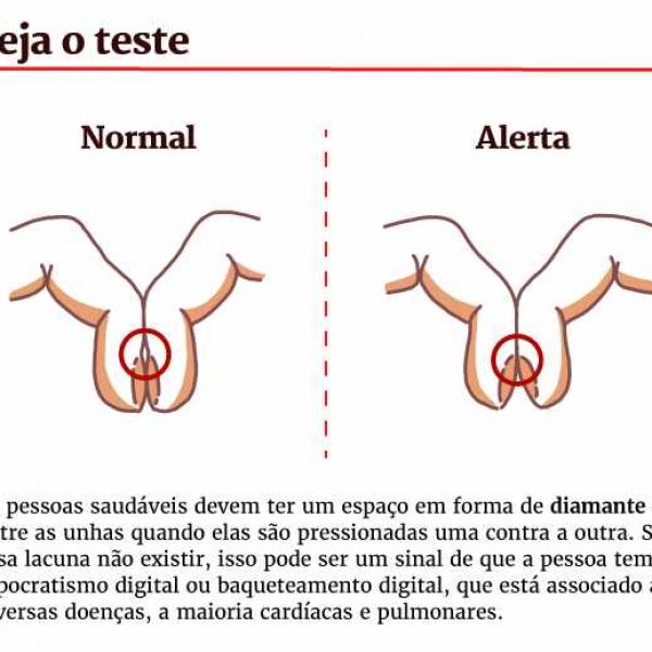 anda a saúde 02