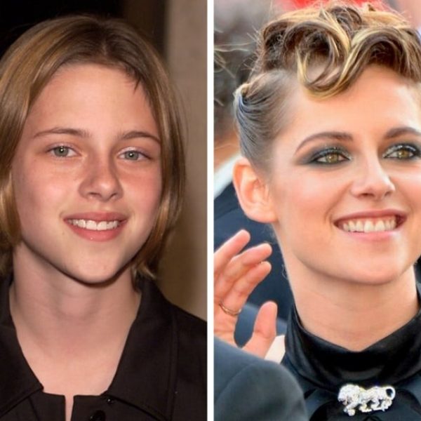 antes e depois 11