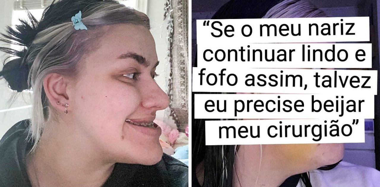 antes e depois capa