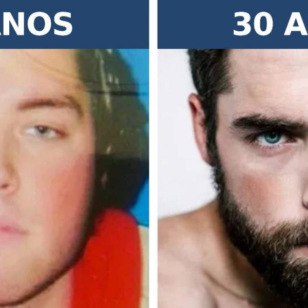 antes e depois capa