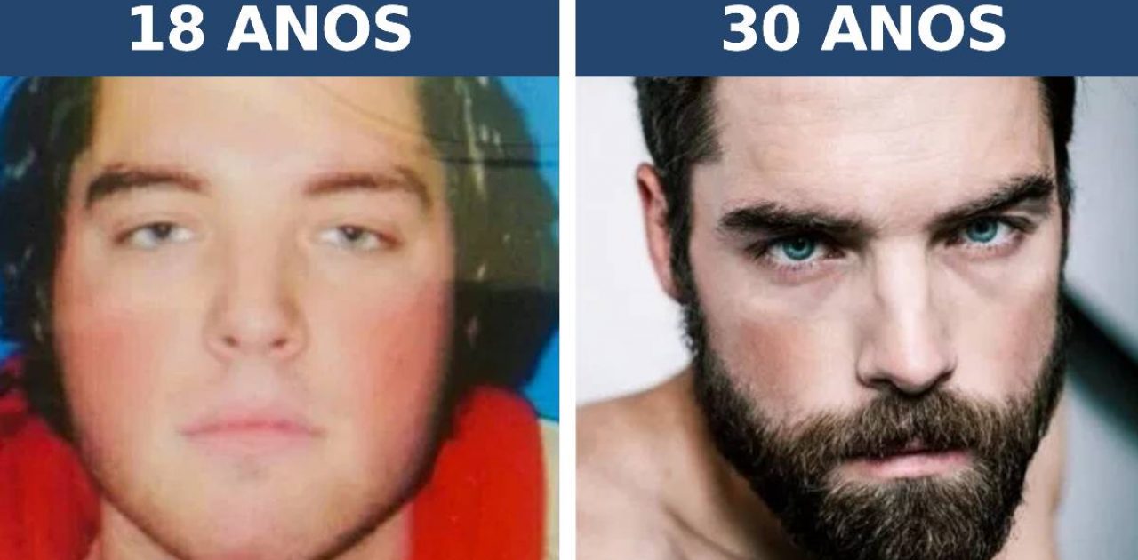 antes e depois capa