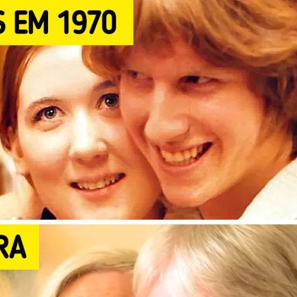 antes e depois capa