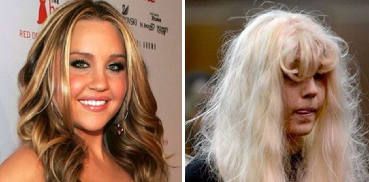 antes e depois das drogas capa