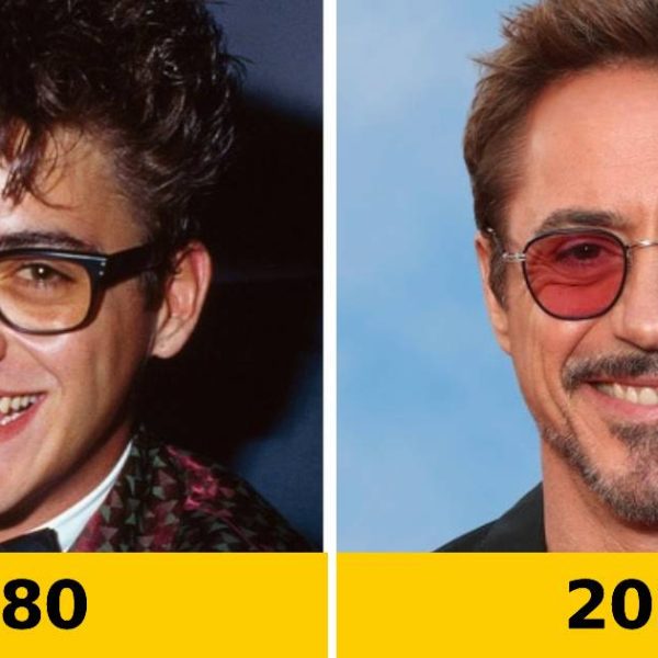antes e depois famosos capa