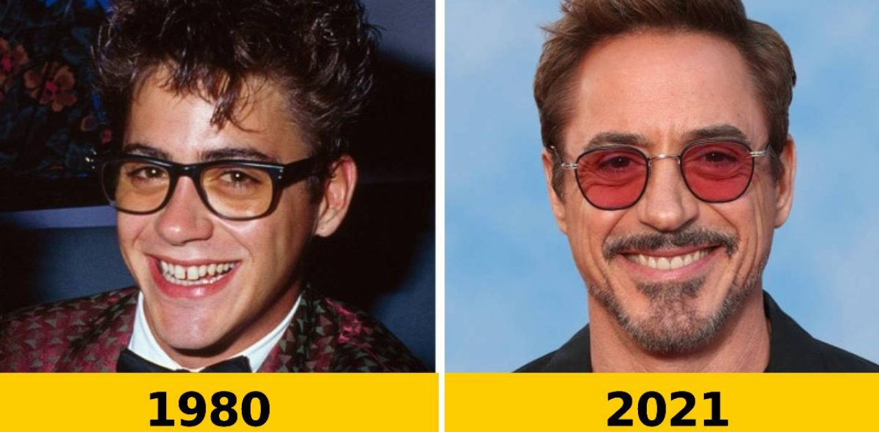 antes e depois famosos capa