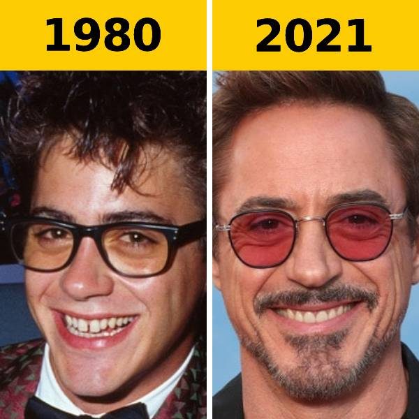antes e depois famosos mobile