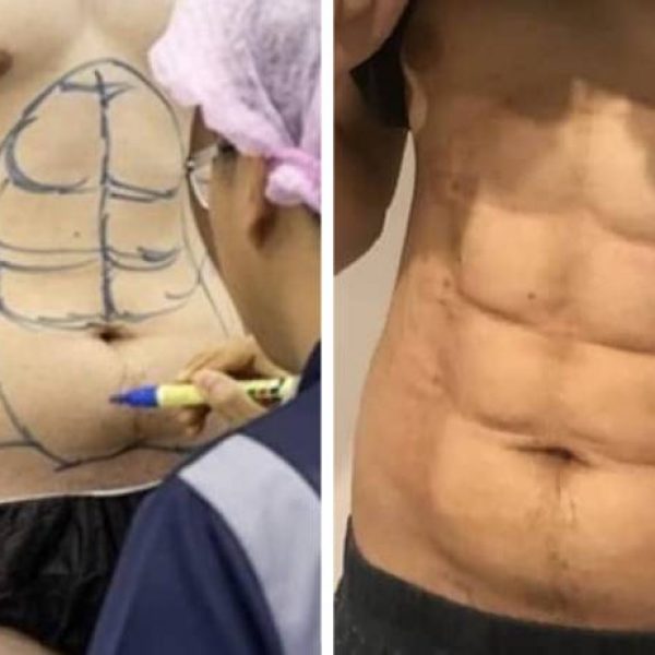 barriga tanquinho capa