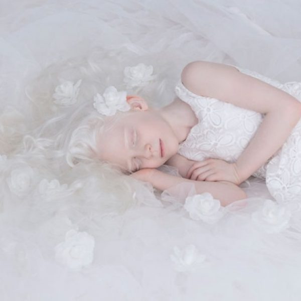 beleza albina 04