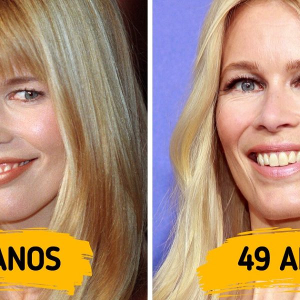 celebridades botox capa
