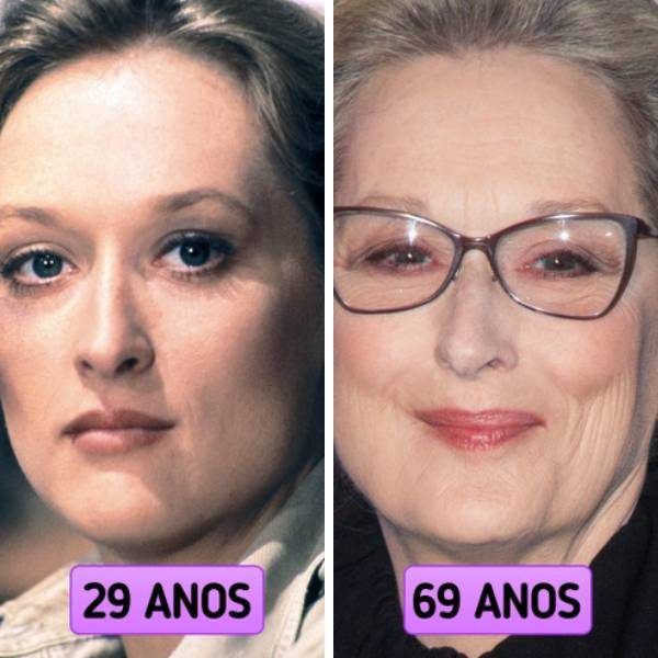 celebridades botox mobile
