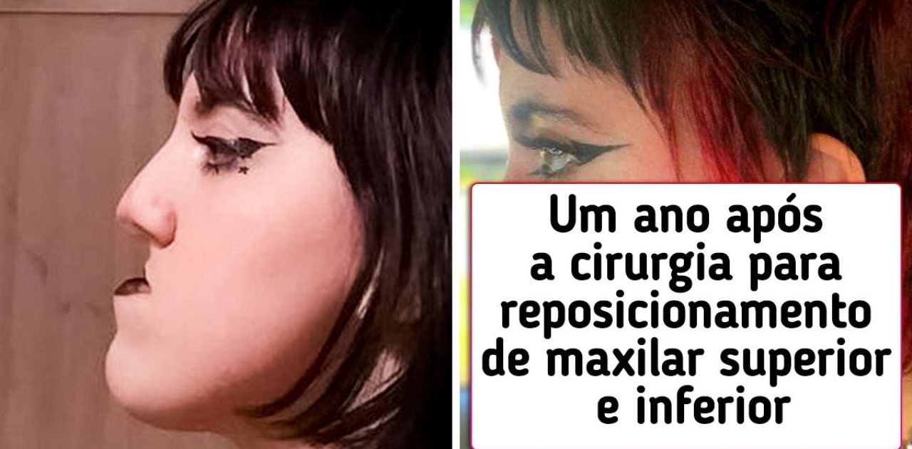 cirurgia plástica capa