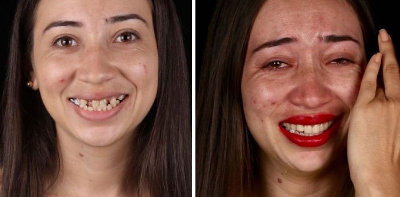 dentisa brasileiro 13
