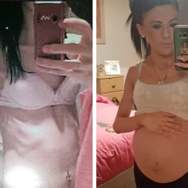 gravidez anorexica capa