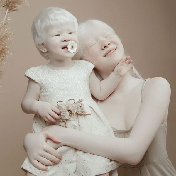irmãs albinas 06