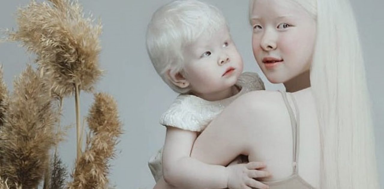 irmãs albinas capa