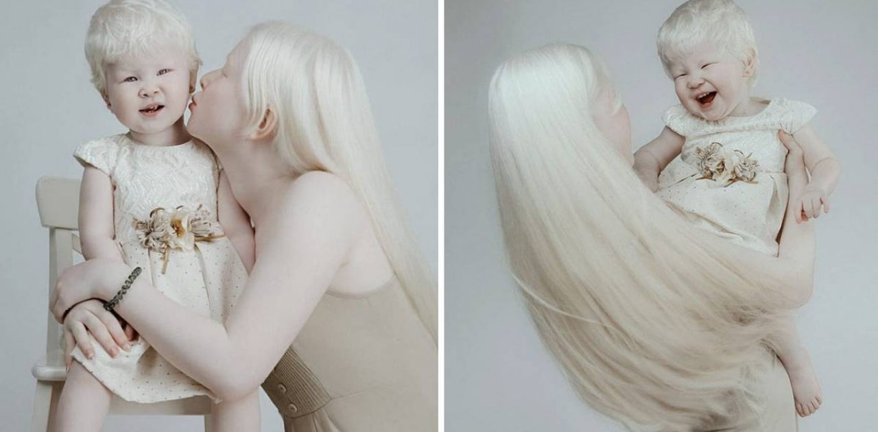 irmãs albinas capa