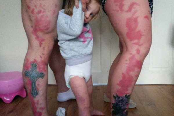 pais tatuam a mancha da filha na pele2