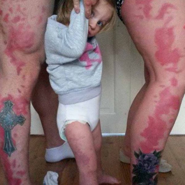 pais tatuam a mancha da filha na pele2