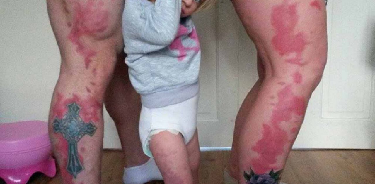 pais tatuam a mancha da filha na pele2