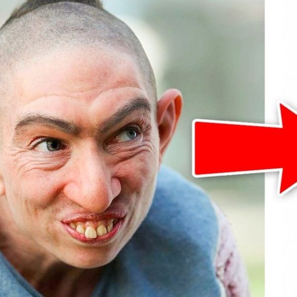 patinho feio capa