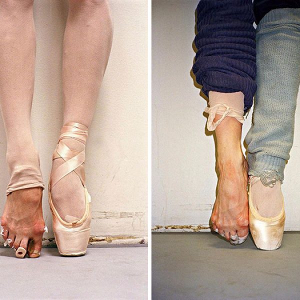 pés de bailarinas capa