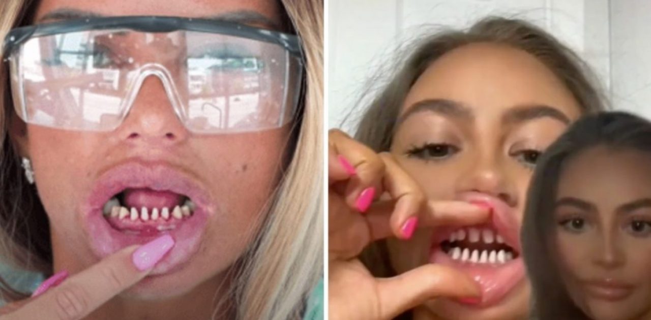 serrar os dentes capa
