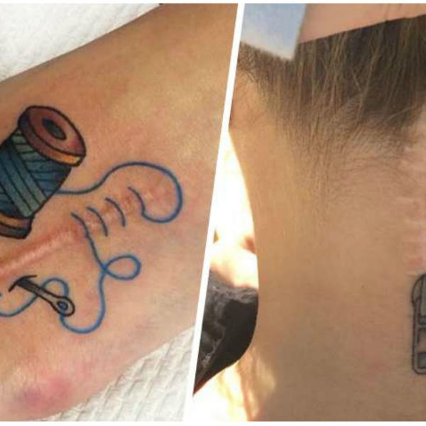 tatuagem cicatriz capa