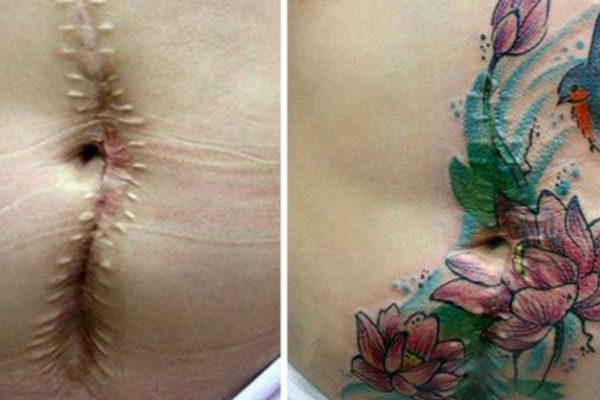 tatuagens na pele capa