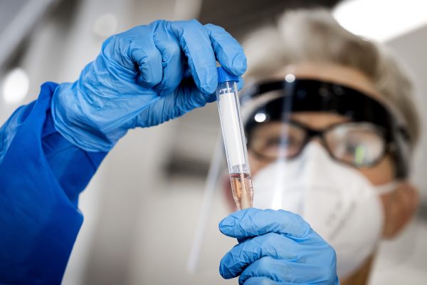 A health worker of the GGD Rotterdam-Rijnmond shows a swab sample for a COVID-19 test in Rotterdam, the Netherlands, on July 29, 2020 as the number of infections with the coronavirus continues to increase in the country, on 29 July 2020. (Photo by Koen Van WEEL / ANP / AFP) / Netherlands OUT