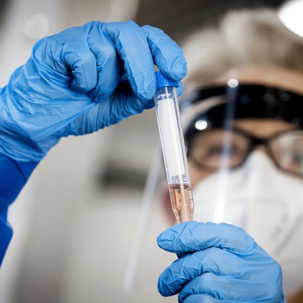 A health worker of the GGD Rotterdam-Rijnmond shows a swab sample for a COVID-19 test in Rotterdam, the Netherlands, on July 29, 2020 as the number of infections with the coronavirus continues to increase in the country, on 29 July 2020. (Photo by Koen Van WEEL / ANP / AFP) / Netherlands OUT