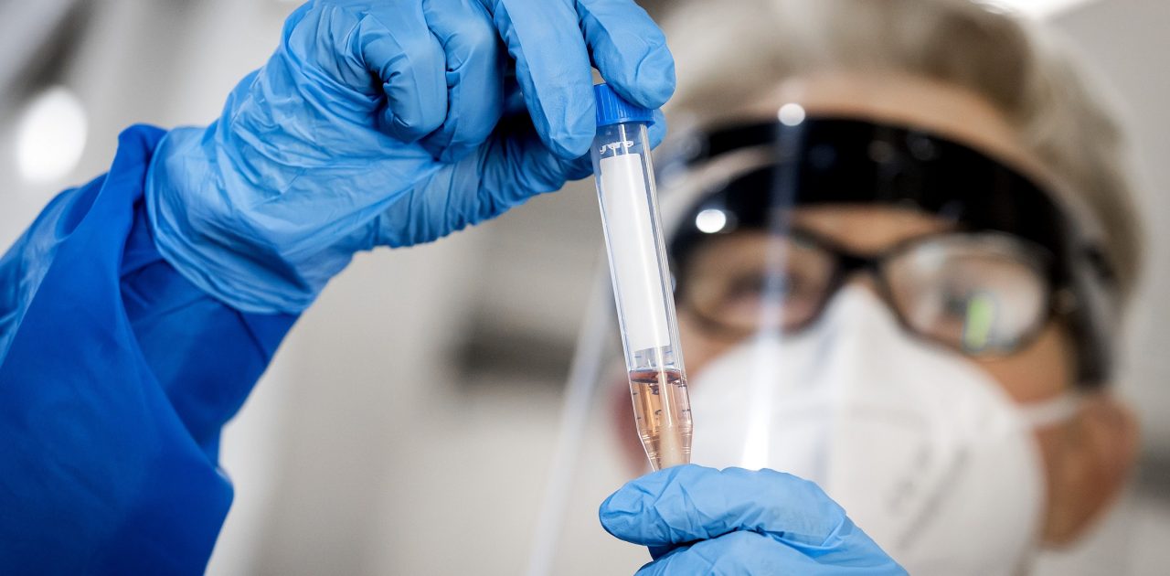 A health worker of the GGD Rotterdam-Rijnmond shows a swab sample for a COVID-19 test in Rotterdam, the Netherlands, on July 29, 2020 as the number of infections with the coronavirus continues to increase in the country, on 29 July 2020. (Photo by Koen Van WEEL / ANP / AFP) / Netherlands OUT